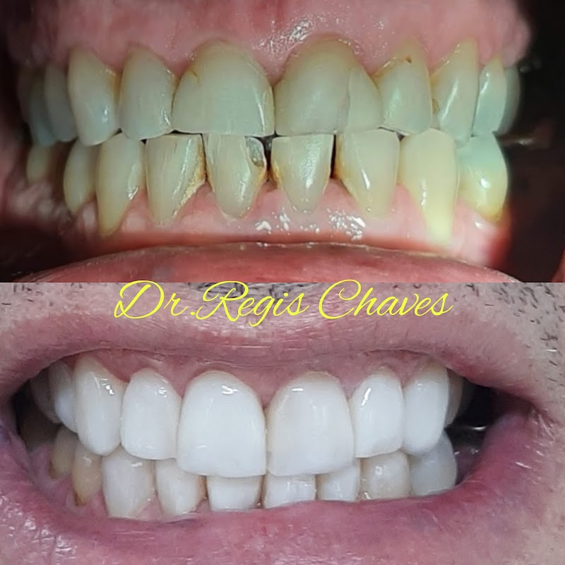 Dentista Dr. Regis | Clínica Odontológica Odonto Chaves