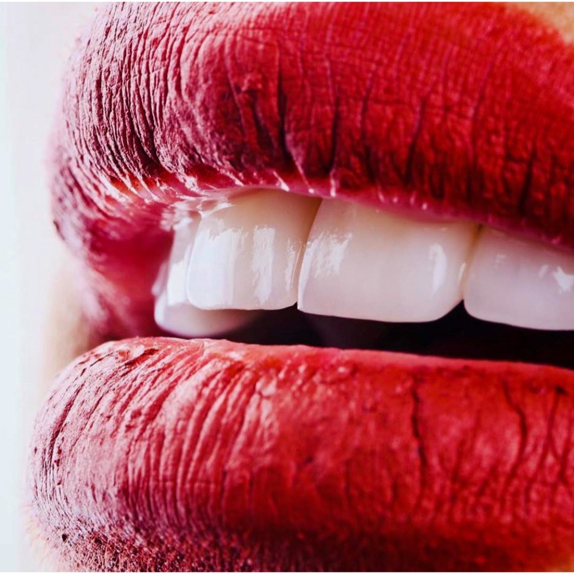 Dr. Parisa Cosmetic Dentist in JLT - Dubai 5