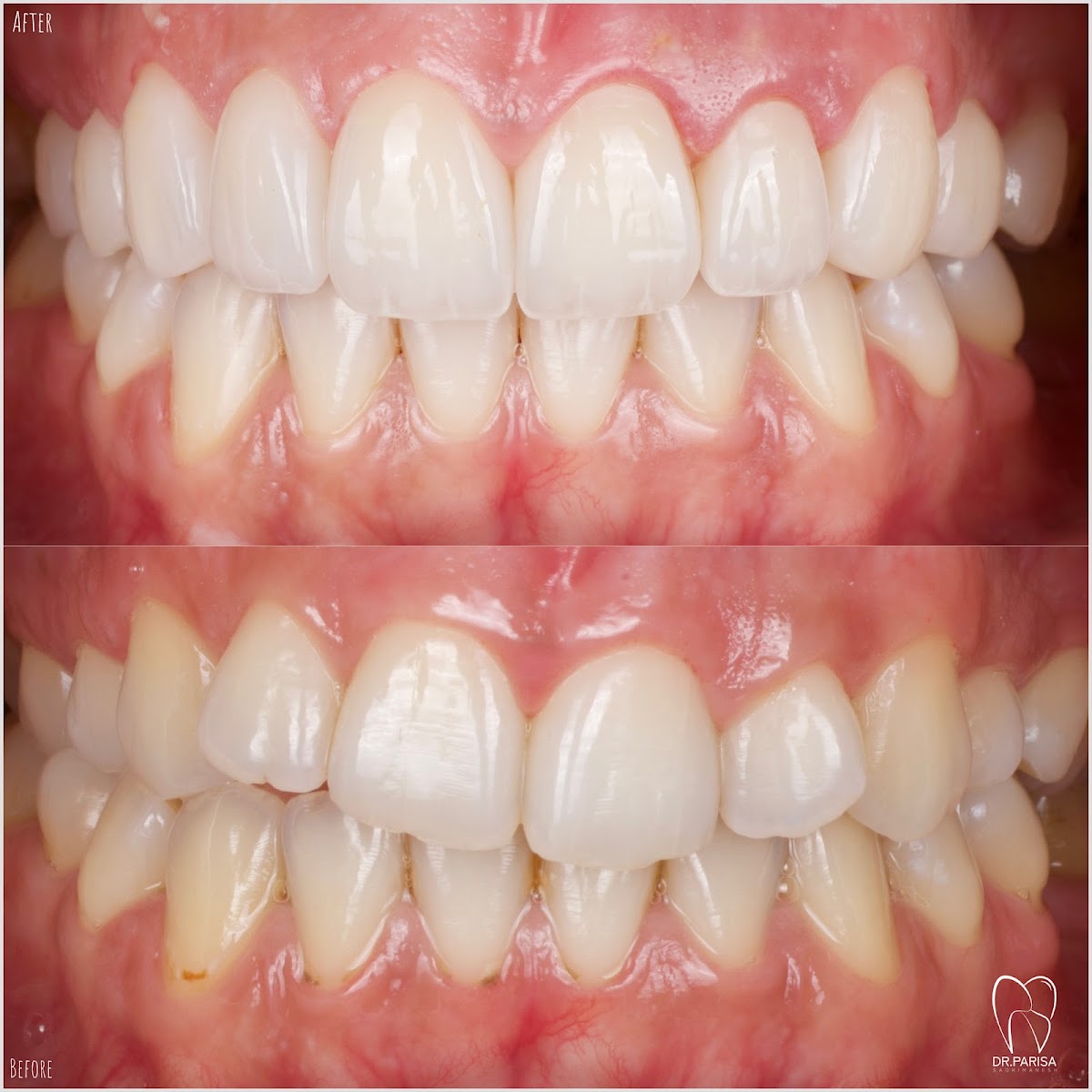 Dr. Parisa Cosmetic Dentist in JLT - Dubai 2