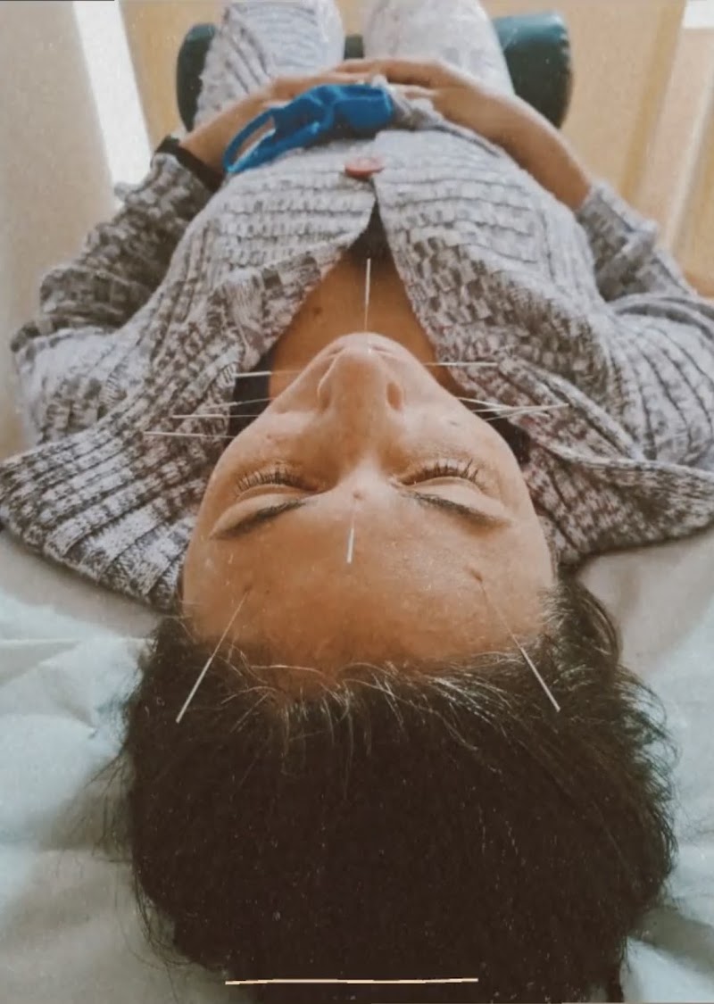 Carolina Damasceno | Acupuntura e Fisioterapia