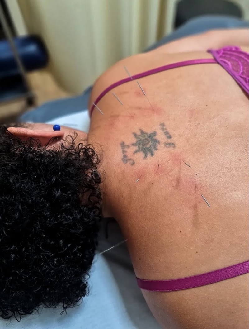 Foto de Carolina Damasceno | Acupuntura e Fisioterapia