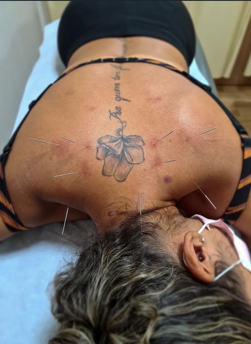 Foto de Carolina Damasceno | Acupuntura e Fisioterapia