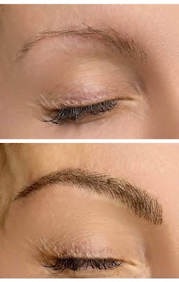 Nimor Aesthetic photo 3