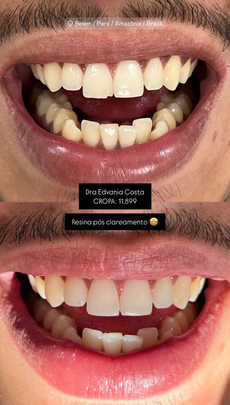 Dra Edvania Costa - Odontologia - foto 4