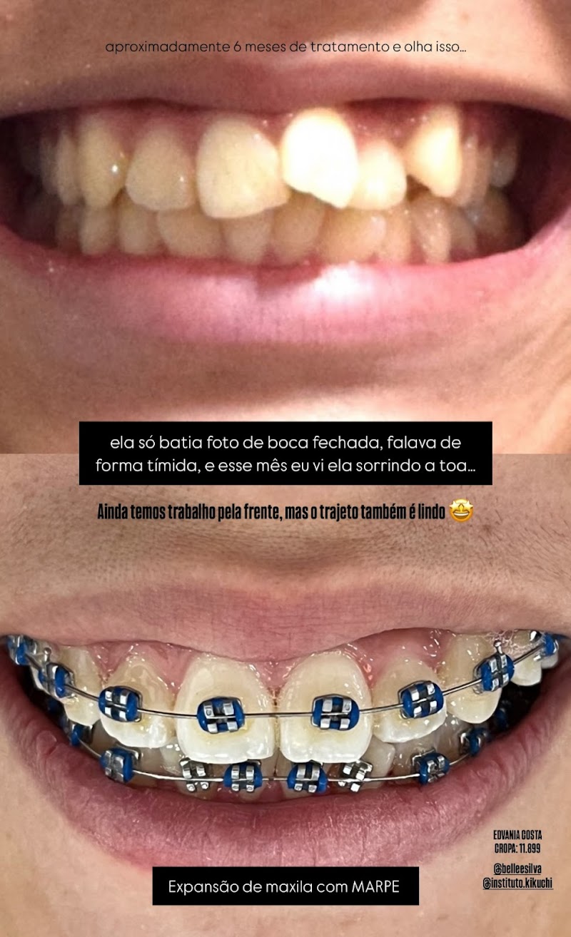 Dra Edvania Costa - Odontologia - foto 5