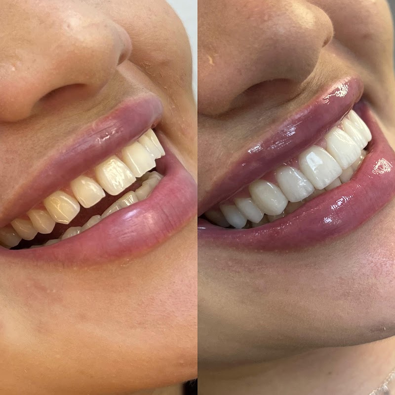 Dra. Keslen Geffer - Odontologia