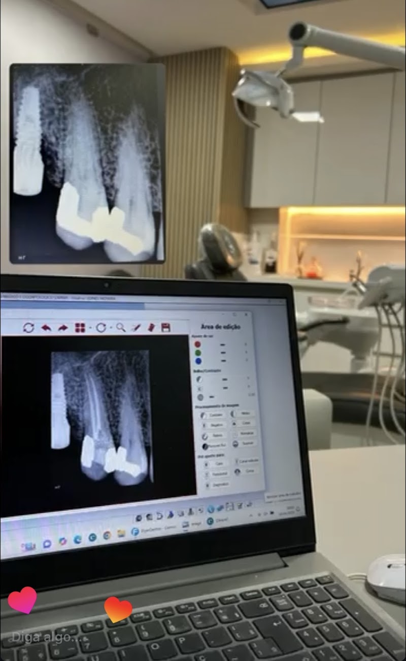 Endodontista em Salvador - Dra Lidinês Moreira - foto 5