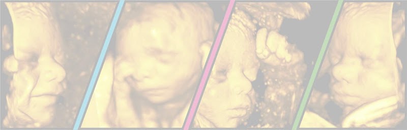 Sneak A Peek Imaging 3D 4D Ultrasounds Houston