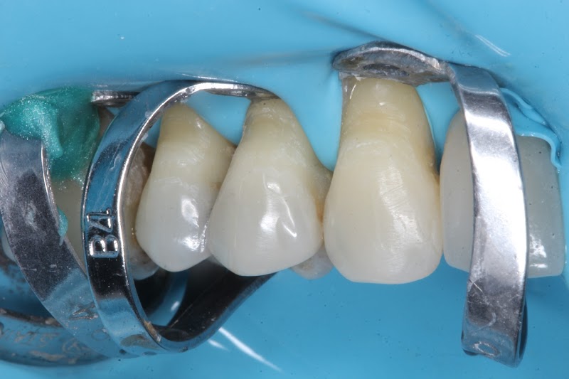 BIOIMPLANTES | Dentista / Clínica Odontológica no Bessa, João Pessoa - PB - foto 2