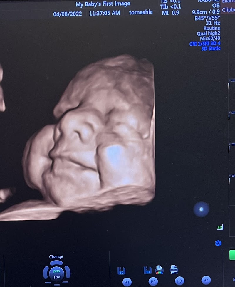 My baby's first image