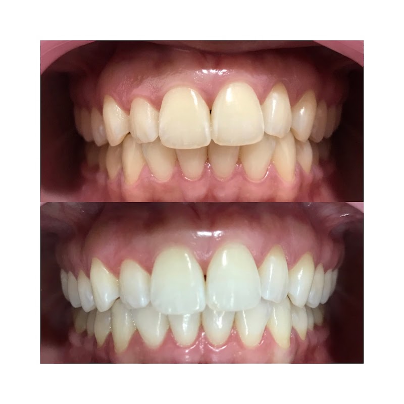 Dra. Ananda Jasson- Dentista. Tratamento de canal- Clareamento dental- Prótese Dentária- Cirurgias- - foto 2