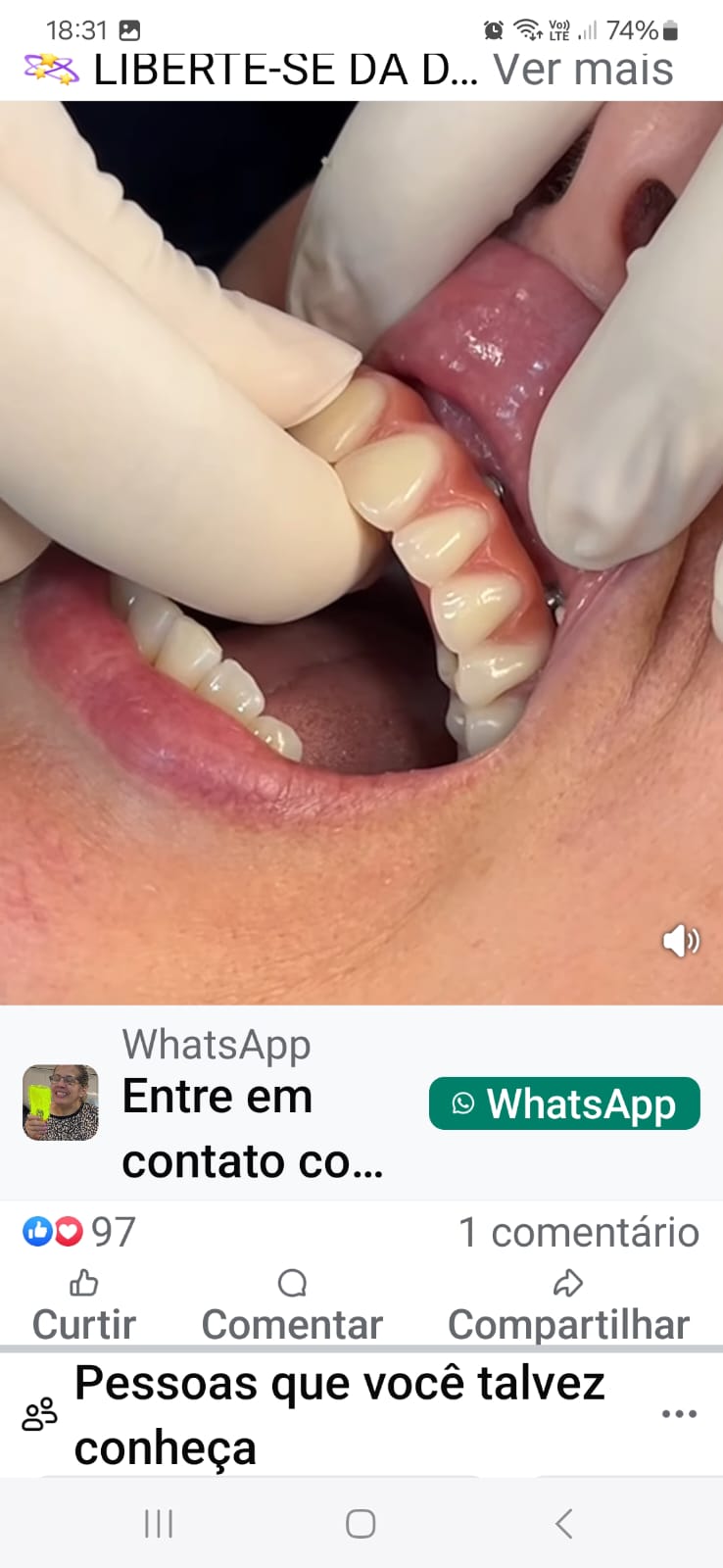 Dentista Av Paulista Dr. Edson Oliveira ( implantodontia ) urgências, próteses, SISO, implantes, claramento, Facetas etc.... - foto 5