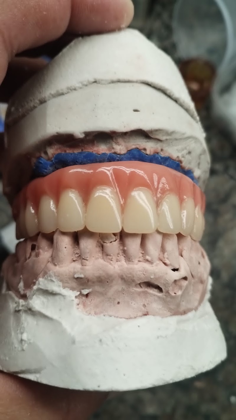 Dentista Av Paulista Dr. Edson Oliveira ( implantodontia ) urgências, próteses, SISO, implantes, claramento, Facetas etc.... - foto 4