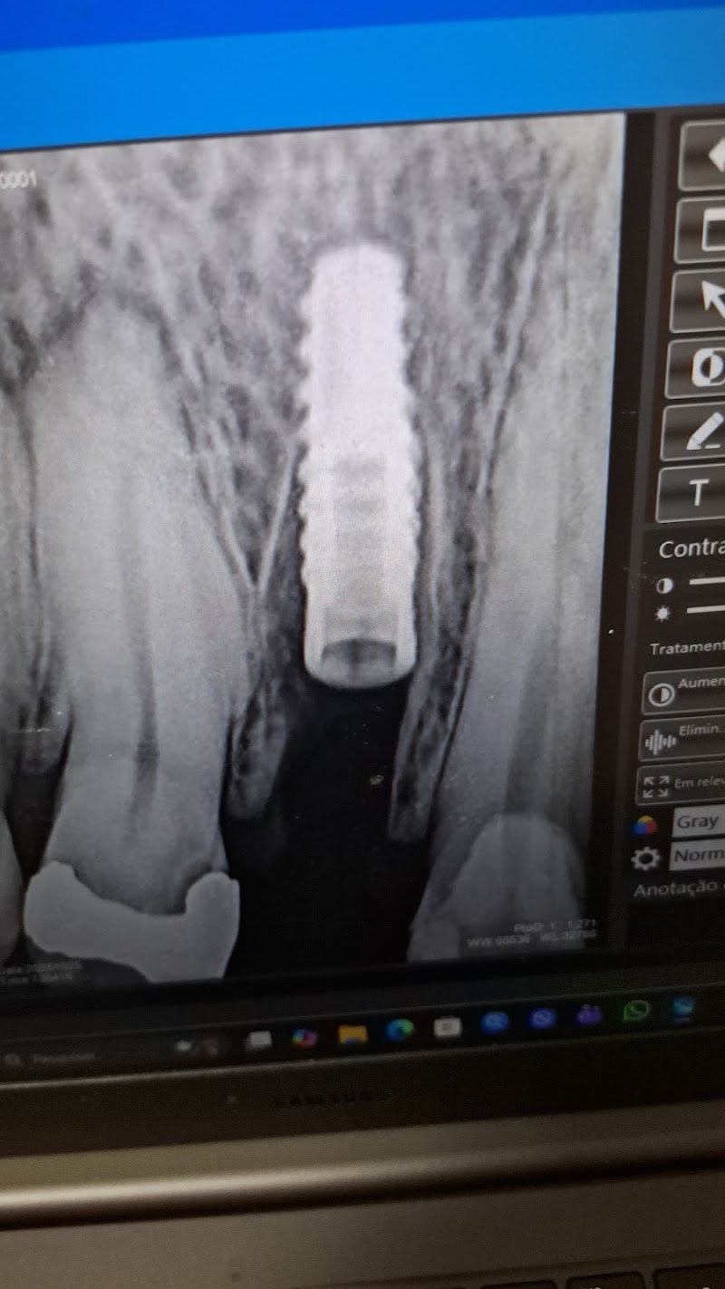 Dentista Av Paulista Dr. Edson Oliveira ( implantodontia ) urgências, próteses, SISO, implantes, claramento, Facetas etc....