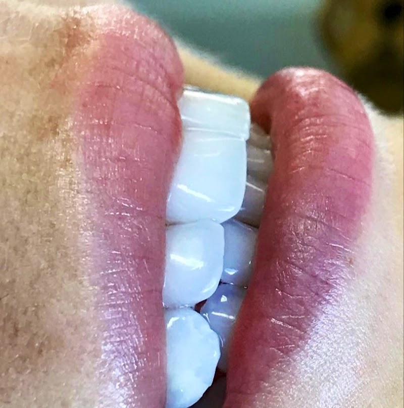 Dra Simone Argenta Scalabrin -Invisalign®️Dr - Endodontista - foto 3