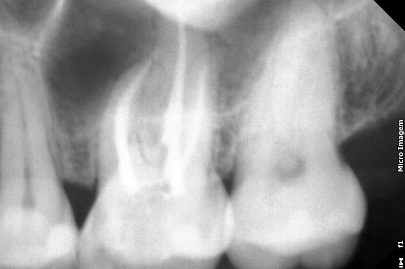 Dra Simone Argenta Scalabrin -Invisalign®️Dr - Endodontista - foto 4