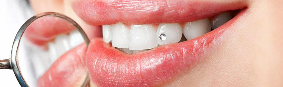 Avance Dental Clinic - Dentist in Deira 4