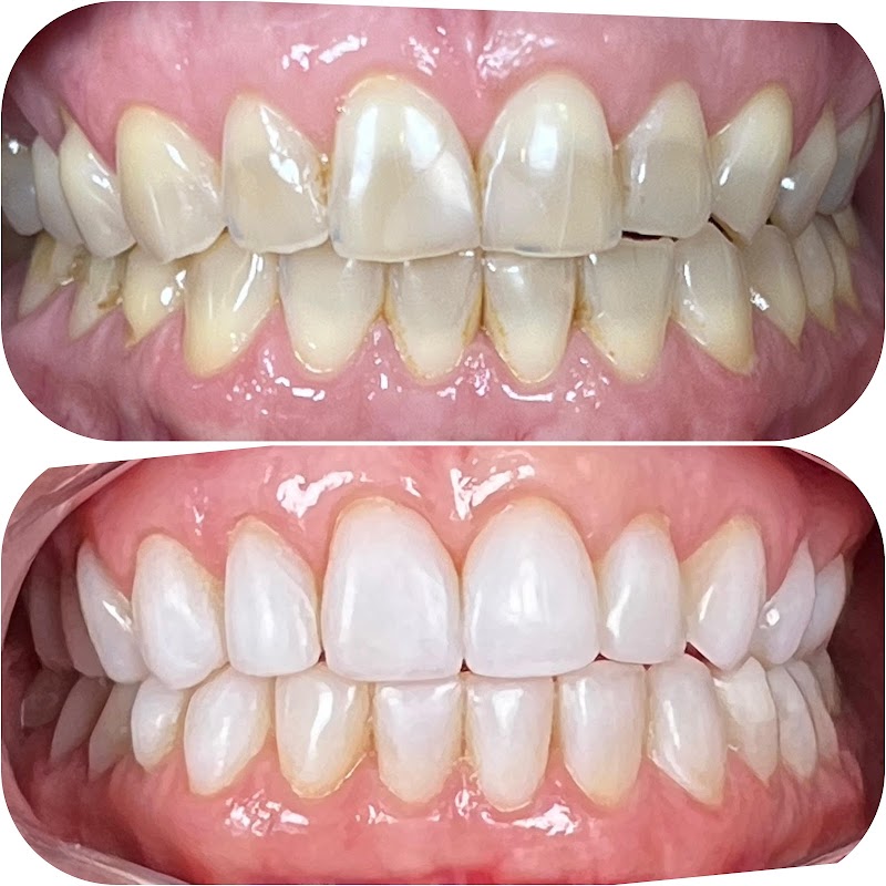 Dra. Nicolle Paulucci - Implantes Dentários e Invisalign - foto 2