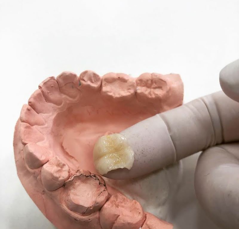 Dra. Silvia Satriuc - Odontologia - foto 4