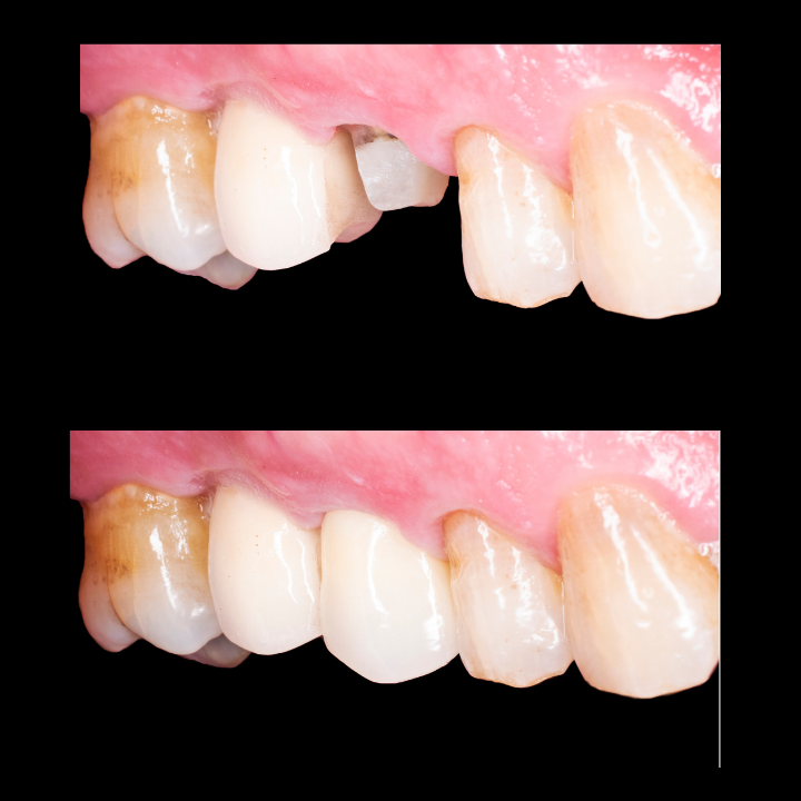 Nitz Odontologia - Especialista em Implantes Dentários - foto 2