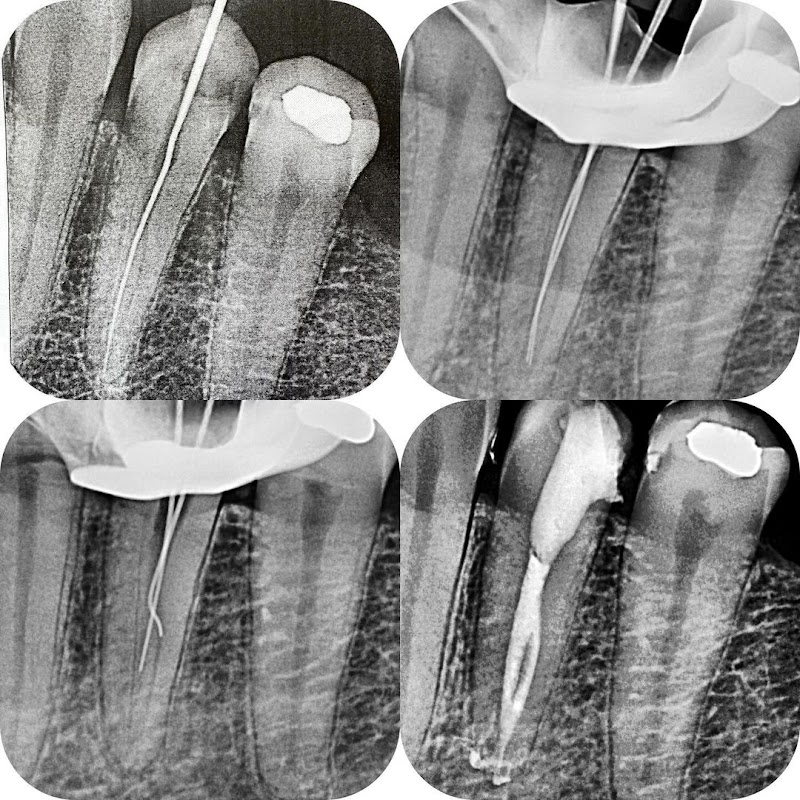 Dr. Jean Campos - Endodontista - foto 4