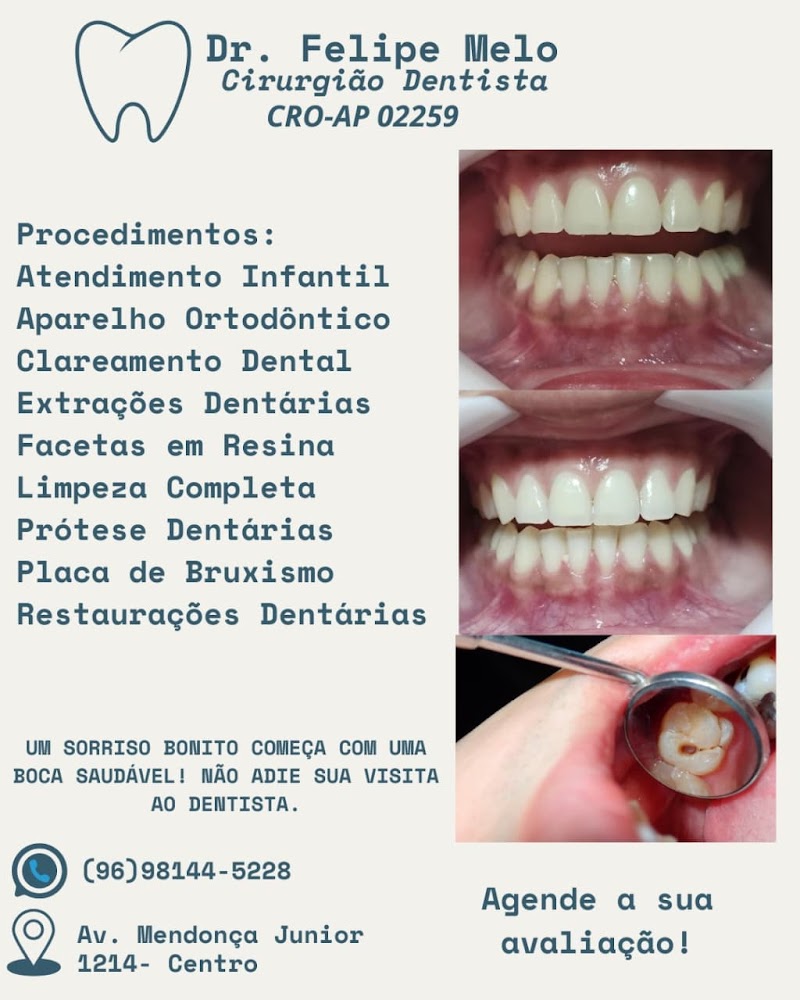 Dr. Felipe Melo | Dentista em Macapá - foto 5
