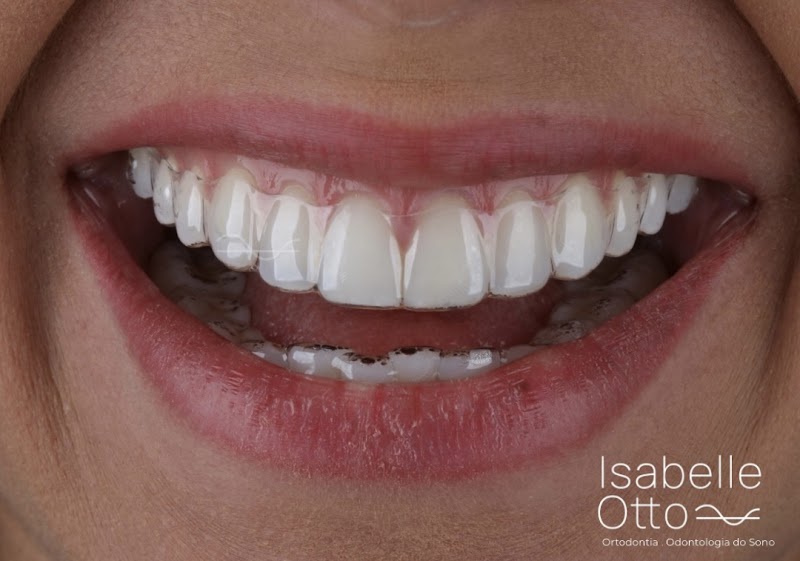 Isabelle Otto | Dentista - foto 3
