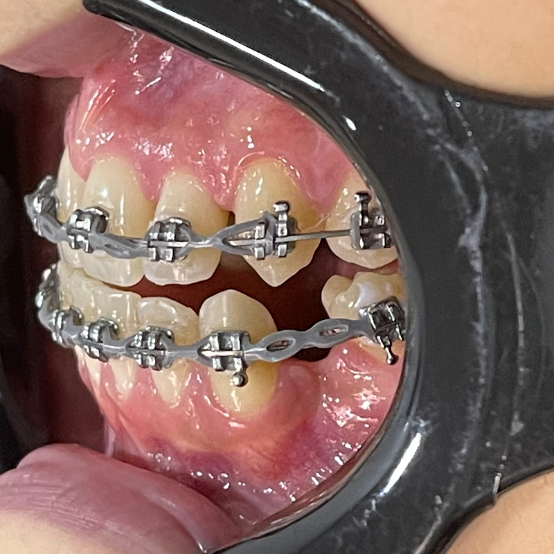 Dra Jamel Salomão - ORTODONTISTA - foto 2