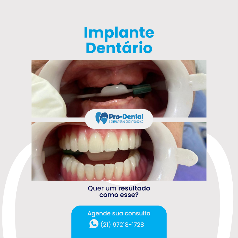 Pro Dental | Implante Dentário Campo Grande RJ - foto 3