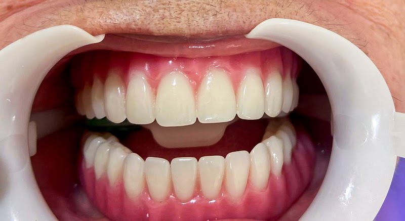 Pro Dental | Implante Dentário Campo Grande RJ - foto 2