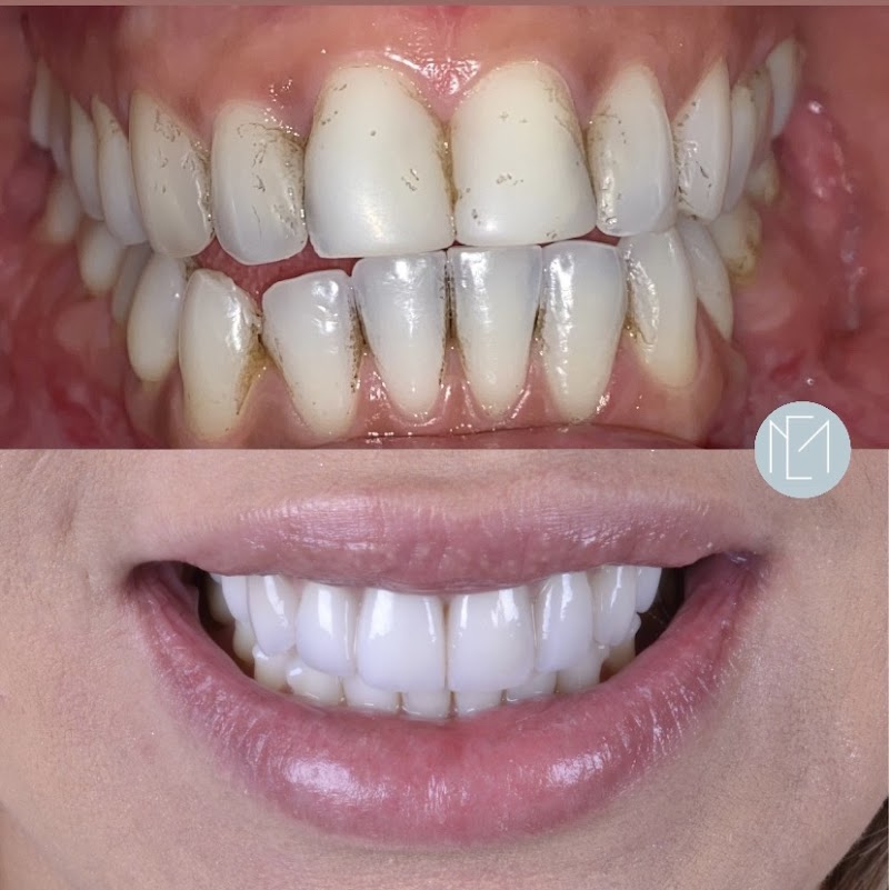 Dra. Elisa Macedo - Dentista Moema | DTM e dor Orofacial, Bruxismo, Prótese, Facetas, Clareamento - foto 2