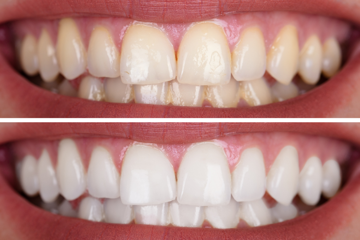Tooth-Tastic 3
