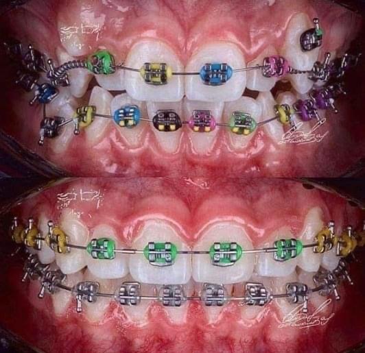 Dentista em Rio Branco 24 horas - foto 5