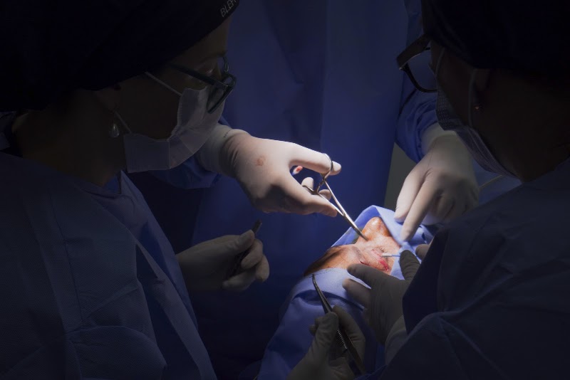 Foto de Blefaroplastia Plástica Ocular Oftalmologista Dr. Cariello