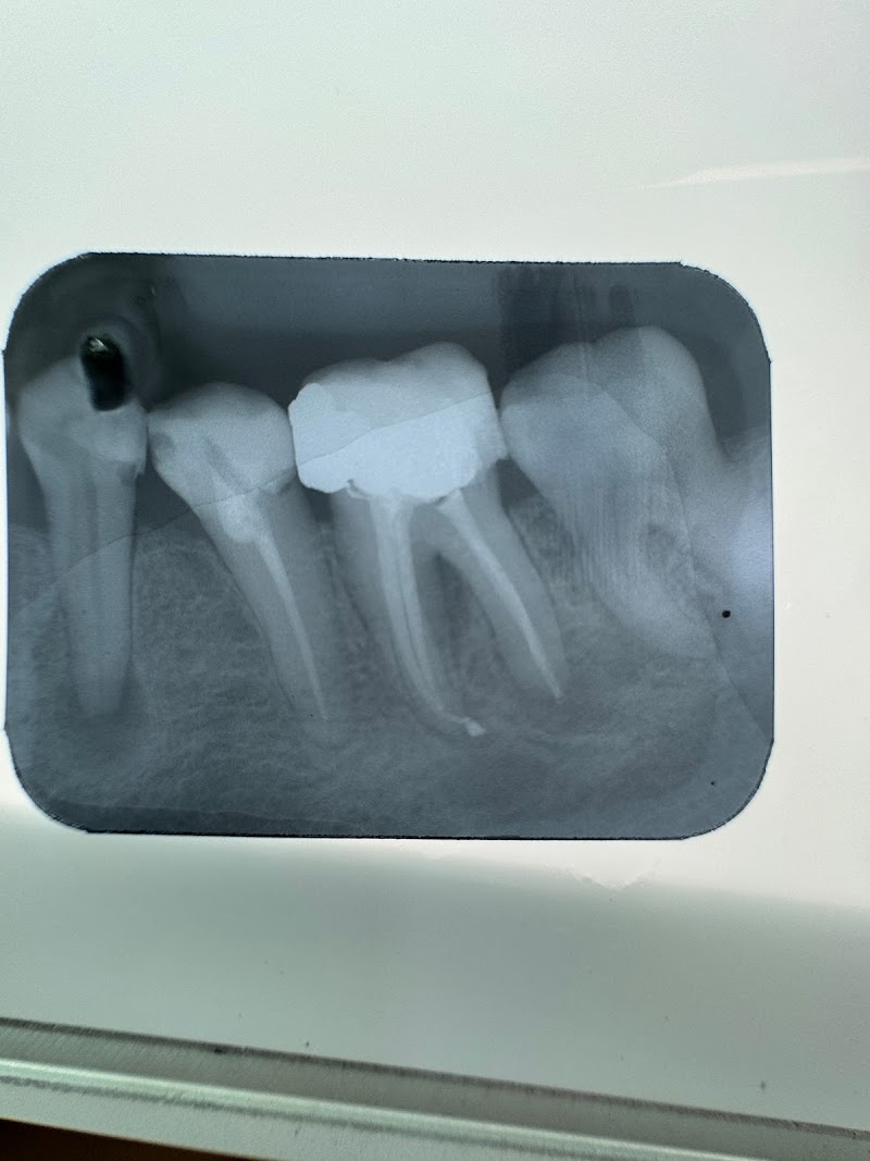 Dra. Paula Amaral - Endodontia - Canal - Clareamento - foto 4