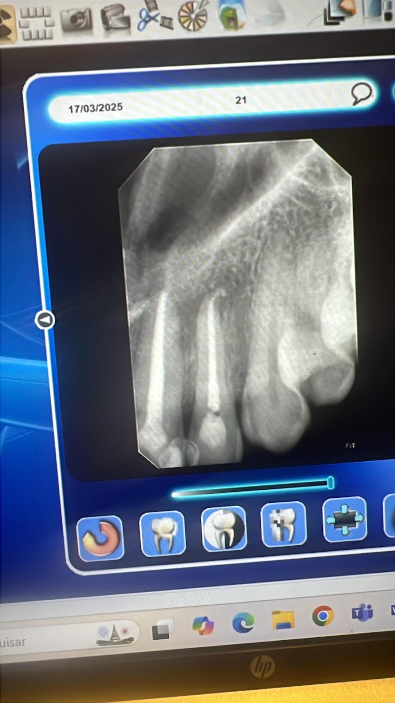 Dentista em João Pessoa - Dra. Larissa Chaves - Dentista e Tratamento de Canal - foto 5