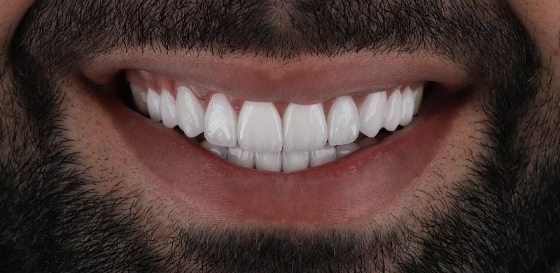 Rei do implante - foto 5