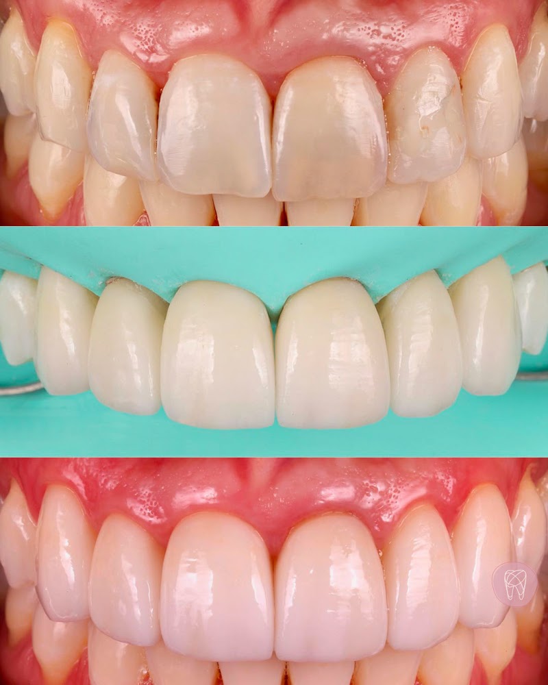 Romero Fernandes Odontologia - Implante Dentário com os melhores Dentistas da Barra da Tijuca - foto 2