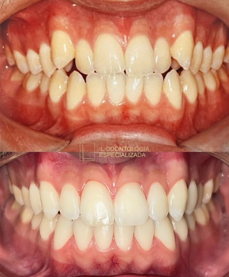 Dentista no Barreiro | IL Odontologia Especializada - foto 4