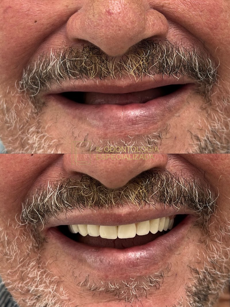 Dentista no Barreiro | IL Odontologia Especializada - foto 3