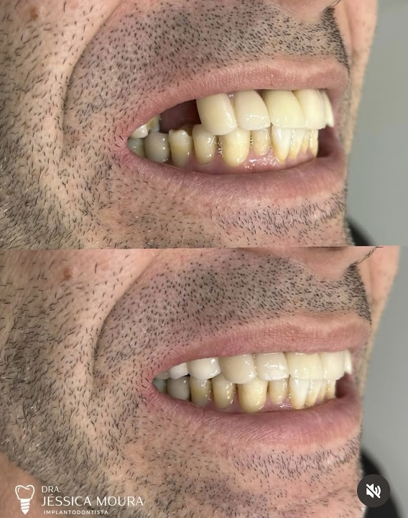 Dra. Jéssica Moura - Implantes Dentários - foto 2