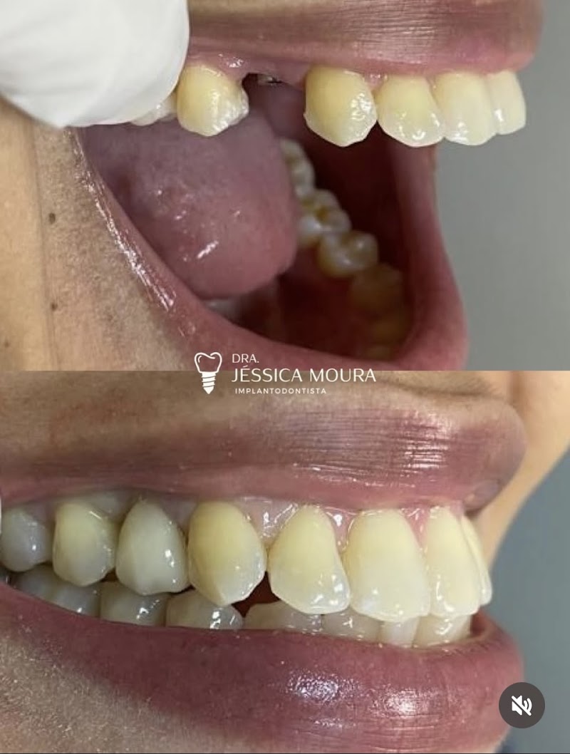 Dra. Jéssica Moura - Implantes Dentários - foto 1