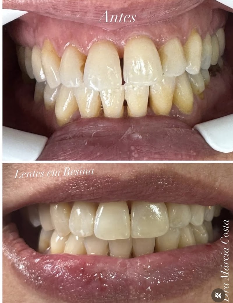 Dentista São Paulo | Dra. Márcia Costa Cedro – Bom Retiro - foto 3