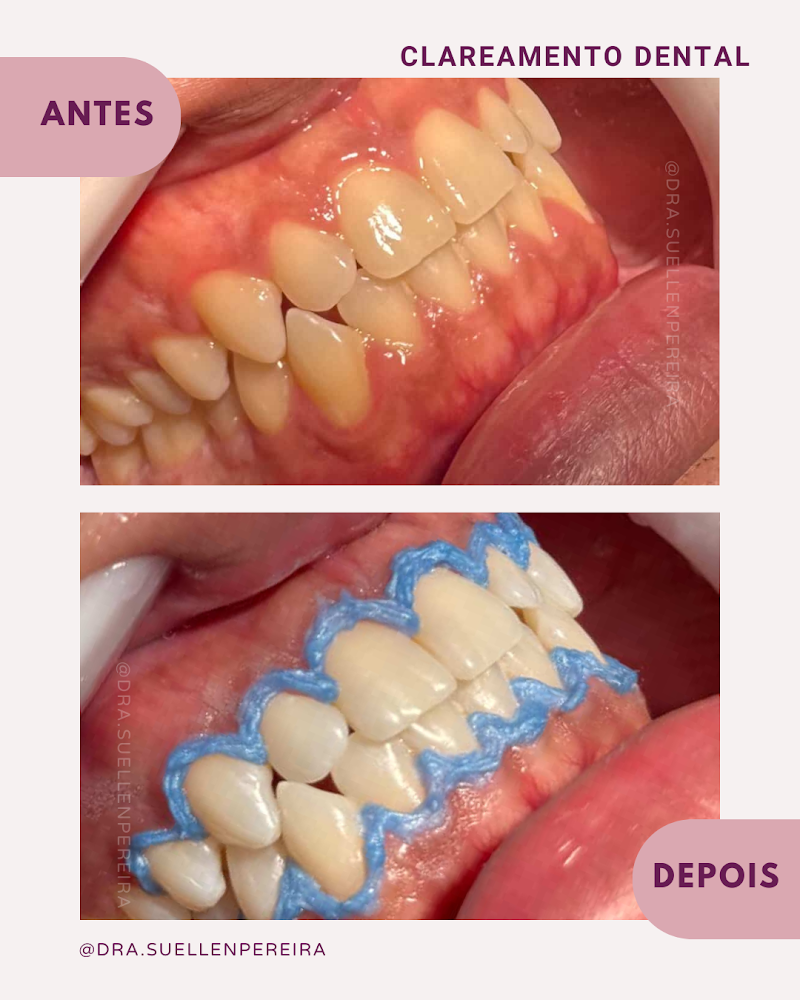Dra. Suellen Pereira/ Dentista em Ribeirão Preto - foto 4
