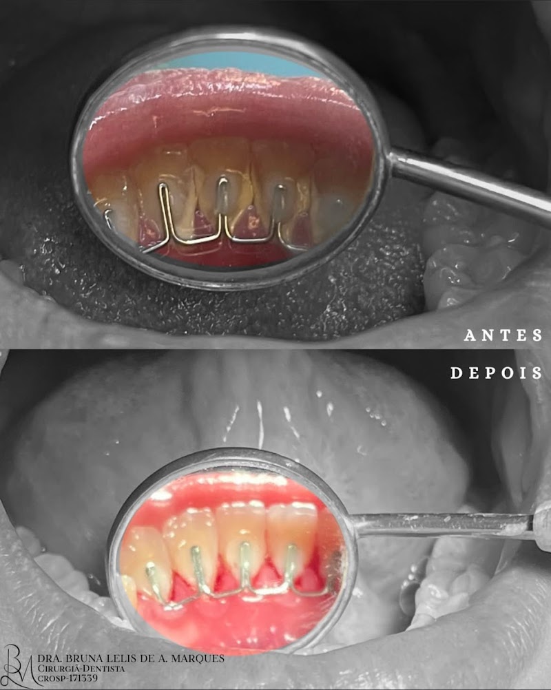 Dra. Bruna Lelis A. Marques | Dentista em Ribeirão Preto - foto 5