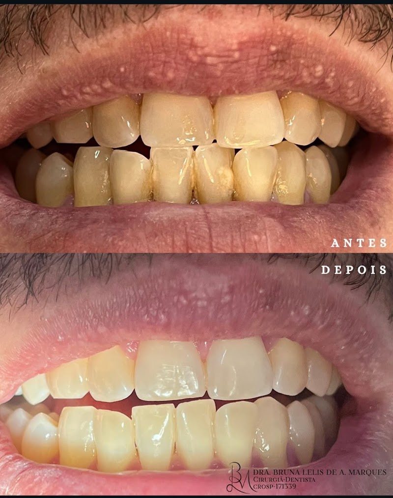 Dra. Bruna Lelis A. Marques | Dentista em Ribeirão Preto - foto 3