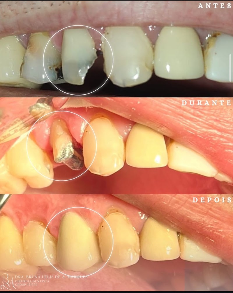 Dra. Bruna Lelis A. Marques | Dentista em Ribeirão Preto - foto 4