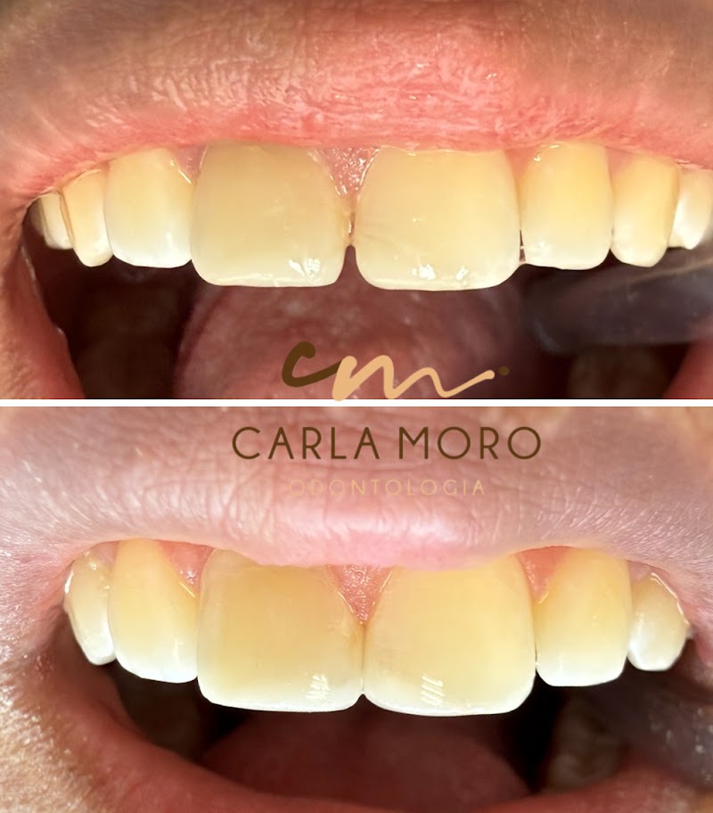 Dra. Carla Moro - CM Odontologia - foto 4