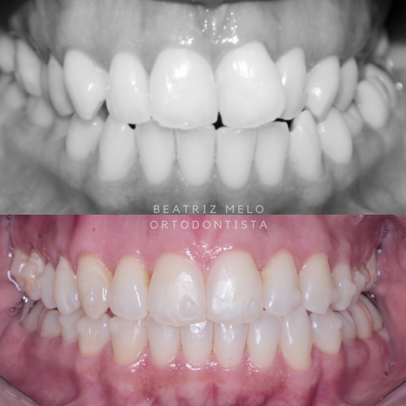Dra. Beatriz Melo - Ortodontia e Odontologia do Sono - foto 4