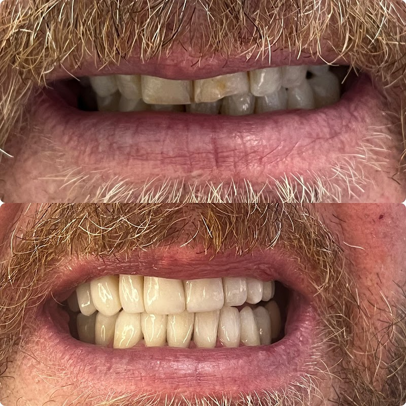 Clínica Odontológica Dra. Cristiane Feris – Estética e Reabilitação Oral em Campinas - foto 5